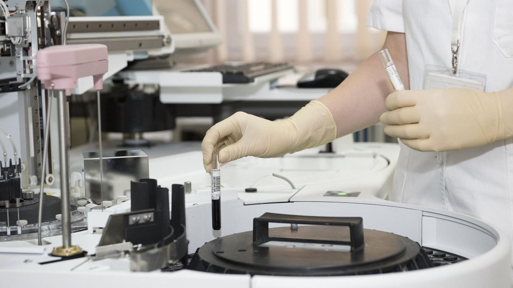 Razvijen prvi test za rano otkrivanje multiple skleroze